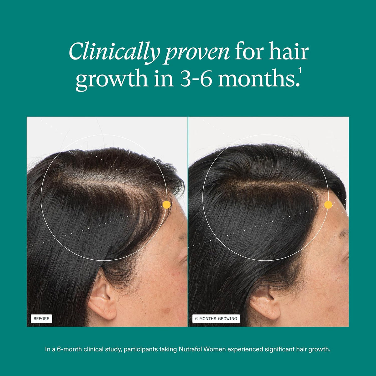 Nutrafol Hair Growth Supplements for Women 120 Capsules