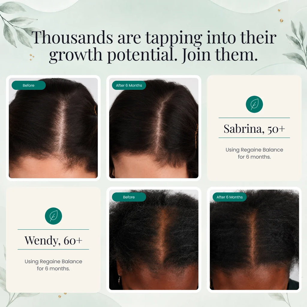 Nutrafol Women's Balance Hair Growth Supplements 120 Capsules