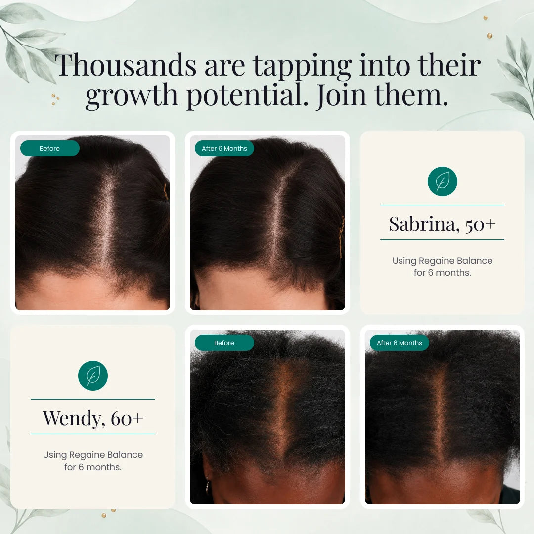 Nutrafol Women's Balance Hair Growth Supplements 120 Capsules