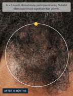 Nutrafol Men Hair Growth Nutraceutical Supplement – 120 Capsules